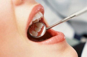 cura denti dentista